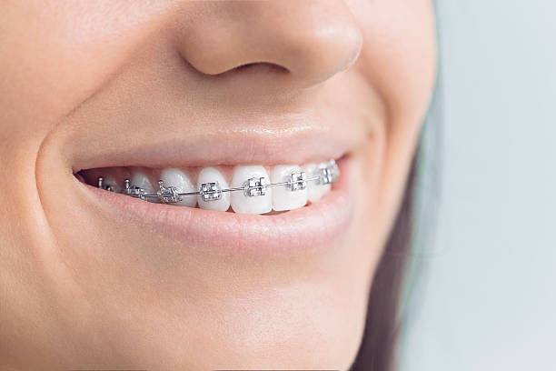 Best Dentures (Full and Partial)  in Mukilteo, WA